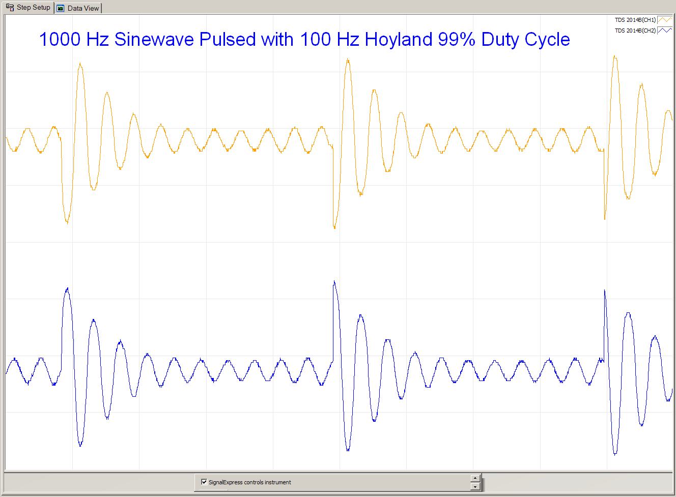 1000Hz Sinewave Pulsed with 100Hz Hoyland 99 Duty Cyle